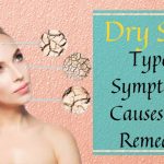 Dry Skin: Types, Symptoms, Causes and Remedies