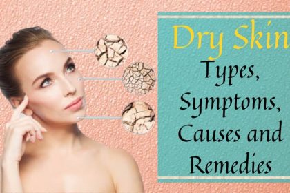 Dry Skin: Types, Symptoms, Causes and Remedies
