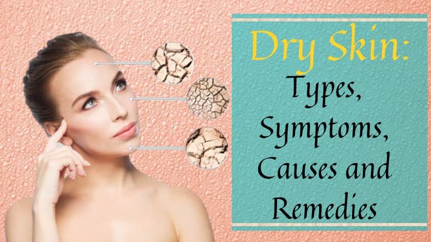 Dry Skin: Types, Symptoms, Causes and Remedies