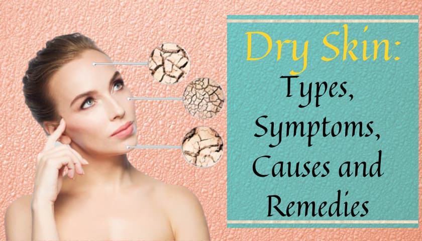 Dry Skin: Types, Symptoms, Causes and Remedies