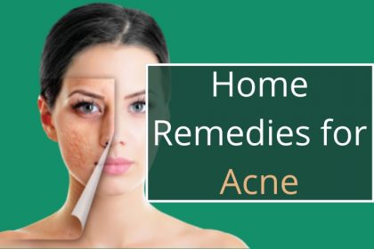 Home Remedies for Acne: Effective ways to get rid of acne