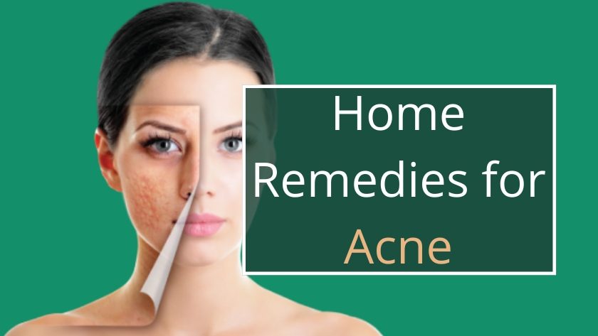 Home Remedies for Acne: Effective ways to get rid of acne