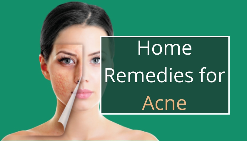 Home Remedies for Acne: Effective ways to get rid of acne